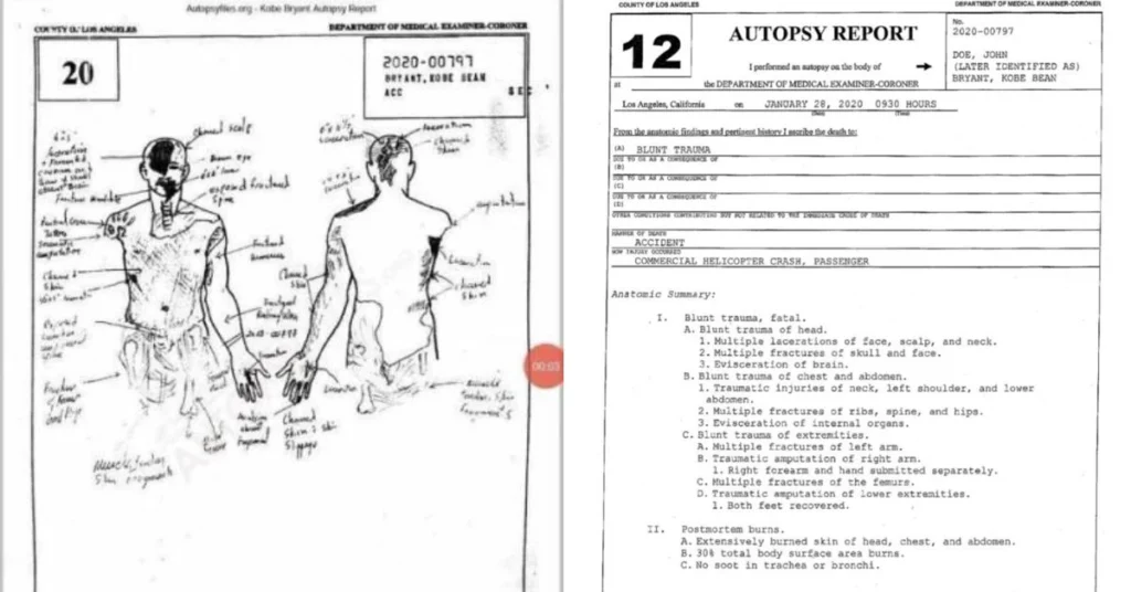 Gigi Autopsy Report PDf Download Causes of Death BTAG Coaching Classes